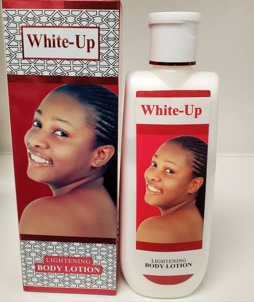 You are currently viewing White Up Lotion Review: My Four Week Trial for Dark Spots.